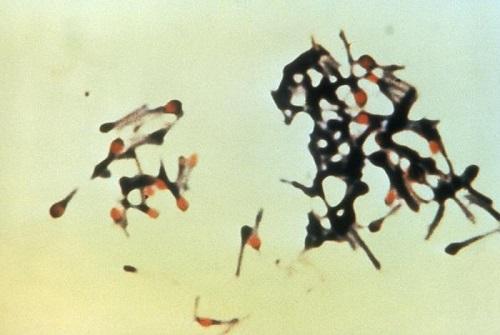 Clostridium tetani: ciri, morfologi, habitat