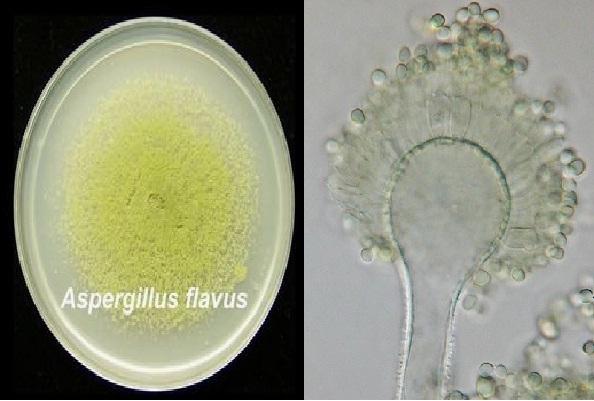 Aspergillus flavus: karakteristik, morfologi, penyakit