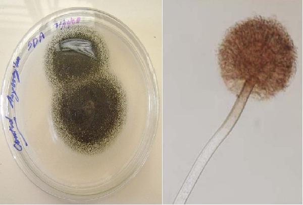 Aspergillus niger: karakteristik, morfologi dan patologi