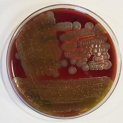 Bacillus cereus: karakteristik, morfologi, habitat
