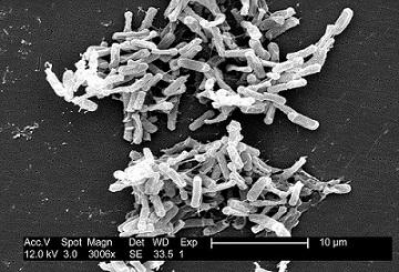 Clostridium difficile: karakteristik, morfologi, habitat