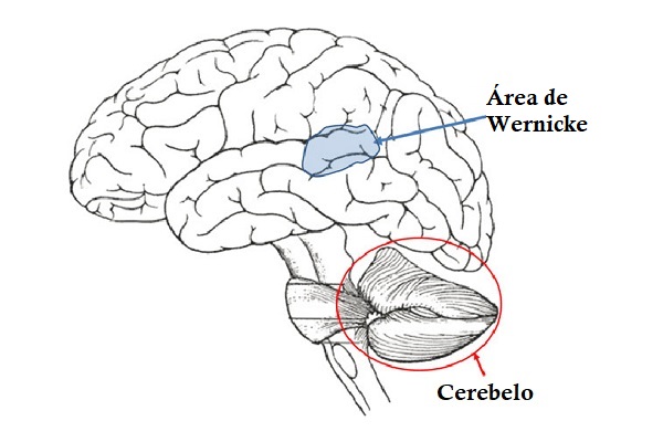 Area Wernicke: fungsi dan anatomi (dengan gambar)