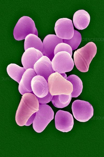 Arthrobacter: karakteristik, taksonomi, morfologi, gejala