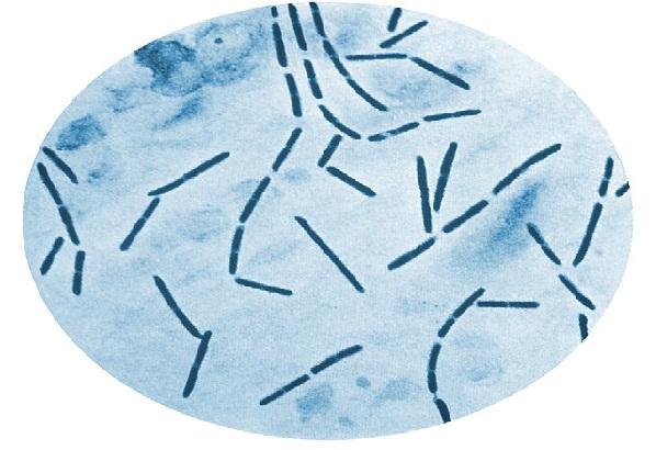 Clostridium septicum: ciri, morfologi, gejala