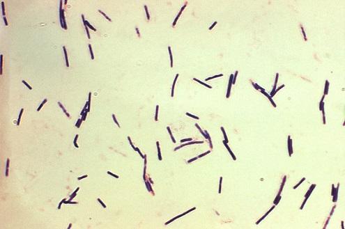 Clostridium perfringens: karakteristik, morfologi, habitat