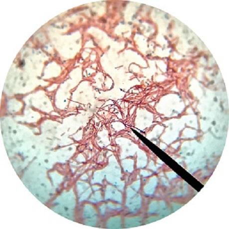 Bacillus subtilis: karakteristik, morfologi, penyakit