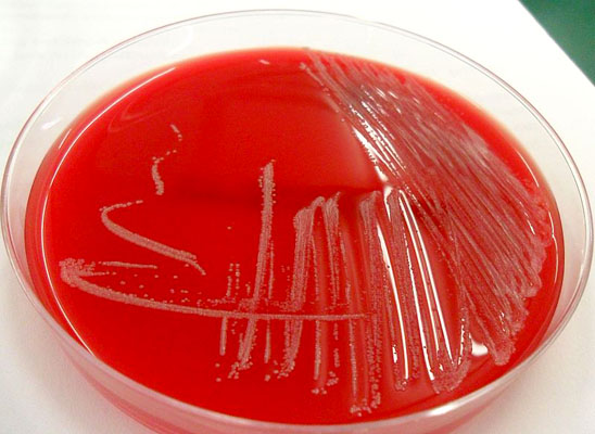Klasifikasi Bakteri: 16 Jenis Utama