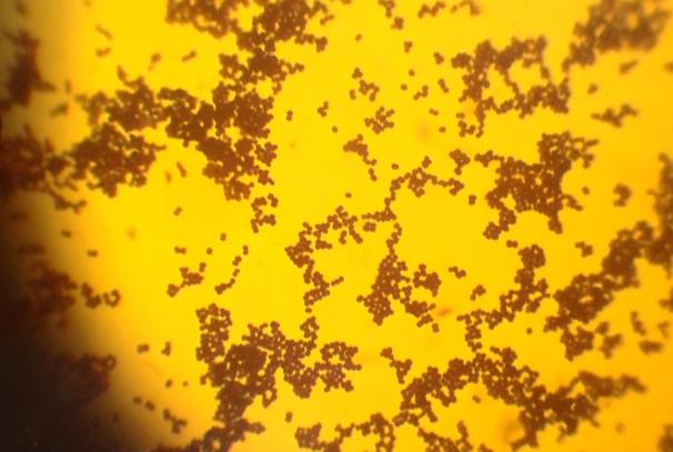 Staphylococcus aureus: karakteristik, morfologi, patogenesis