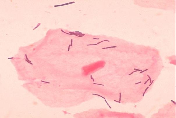 Lactobacillus acidophilus: karakteristik, taksonomi, morfologi