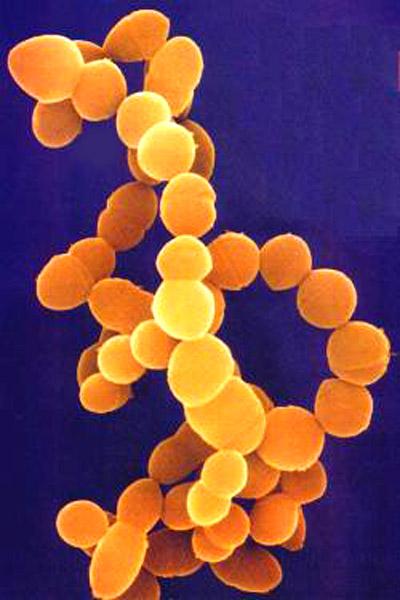 Lactococcus: karakteristik, morfologi, manfaat, patogenesis