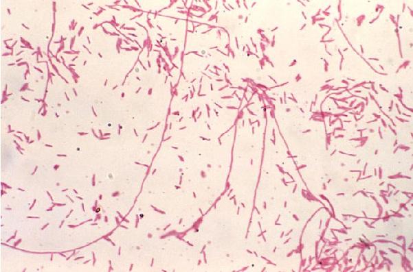 Legionella pneumophila