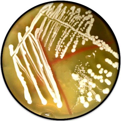 Lactobacillus plantarum: karakteristik, morfologi, aplikasi