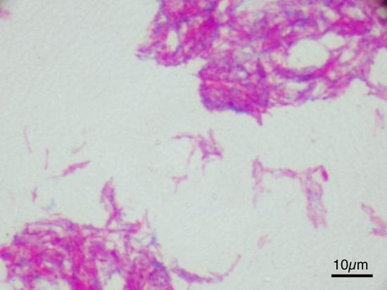 Mycobacterium bovis: karakteristik, morfologi dan patogenesis