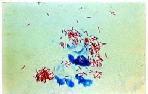 Mycobacterium leprae: karakteristik, morfologi, kultur