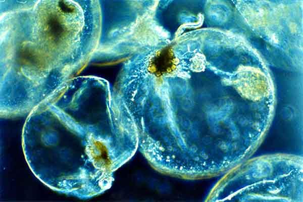 Plankton: karakteristik, jenis, makan dan reproduksi