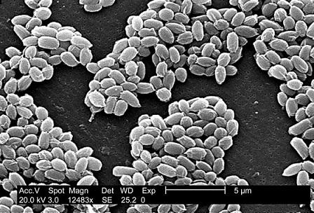 Bacillus anthracis: taksonomi, karakteristik, penyakit