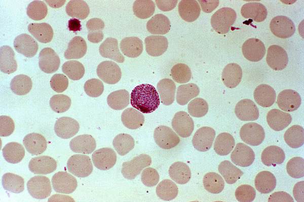 Plasmodium vivax: morfologi, siklus hidup dan gejala