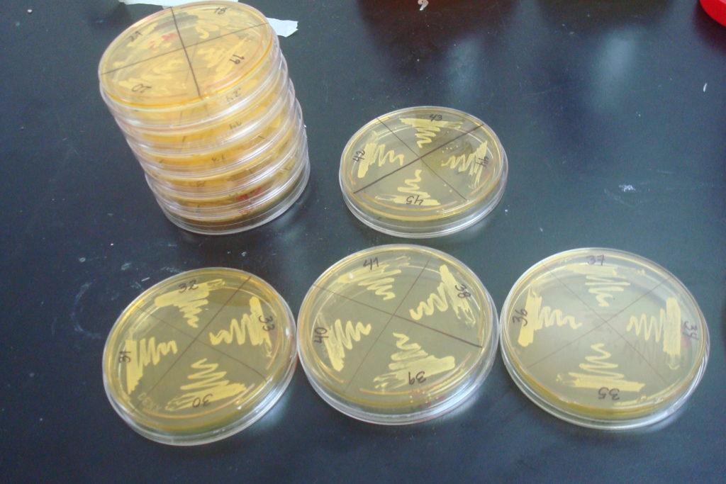 Staphylococcus aureus: karakteristik, morfologi, patogenesis