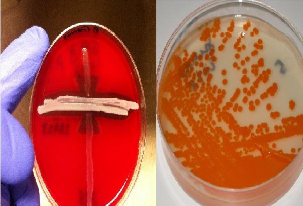 Streptococcus agalactiae: karakteristik, morfologi, patologi