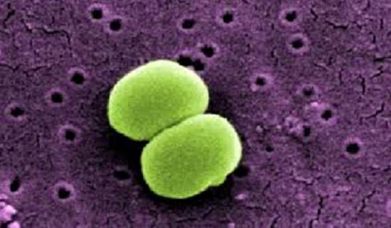 Staphylococcus epidermidis: karakteristik, morfologi