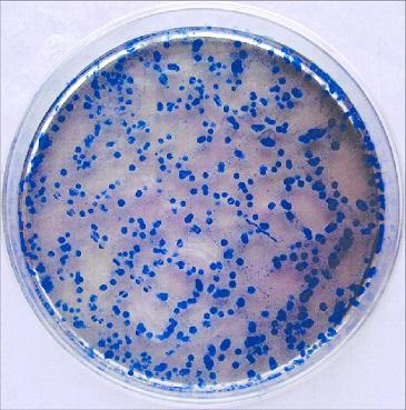 Streptococcus mitis: karakteristik, taksonomi, patologi