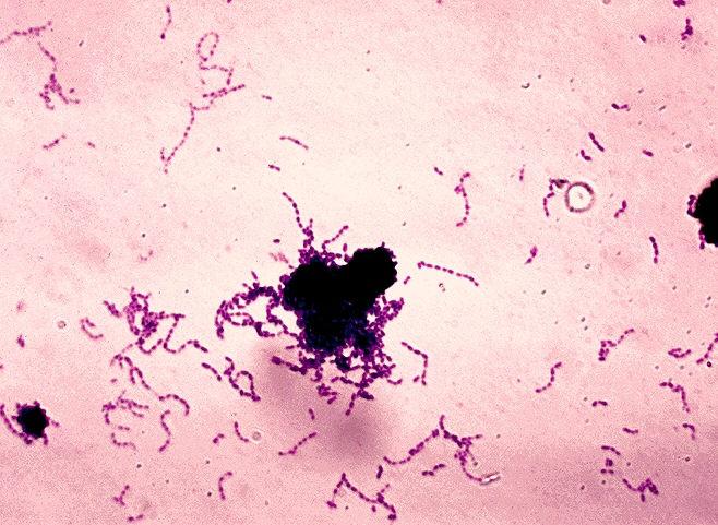 Streptococcus mutans: karakteristik, penyakit