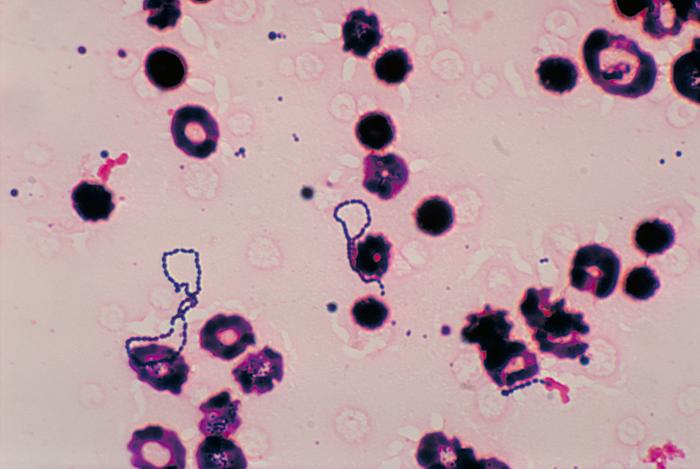 Streptococcus viridans: karakteristik, siklus hidup, dan gejala