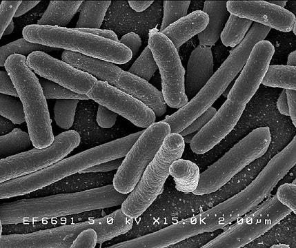 Klasifikasi Bakteri: 16 Jenis Utama