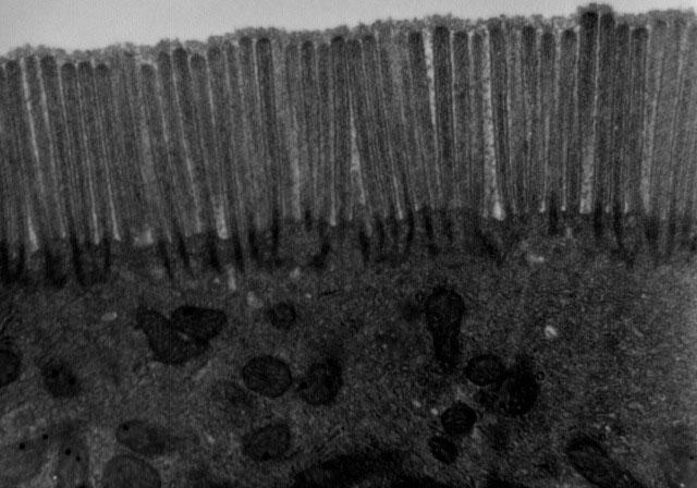 mikrovili terlihat di bawah mikroskop