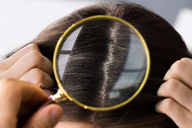 Apa penyebab rambut rontok?