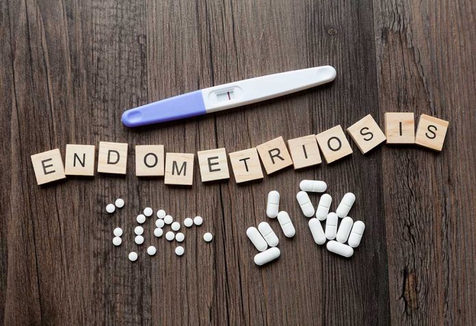 apakah ivf merupakan pilihan yang baik untuk wanita dengan endometriosis?