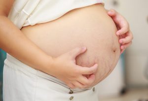 Apa Gejala Kolestasis Obstetrik pada Kehamilan?