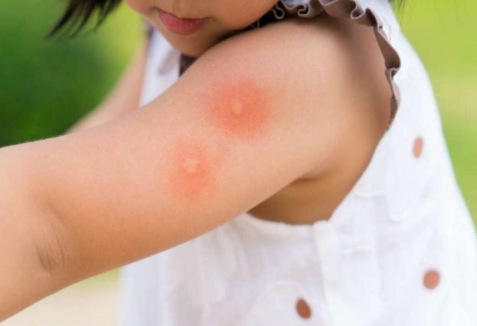 4 kali sehari ketika anak-anak berada pada risiko maksimum penyakit yang ditularkan oleh nyamuk2