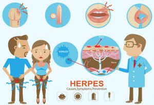 Herpes Kelamin dalam Kehamilan