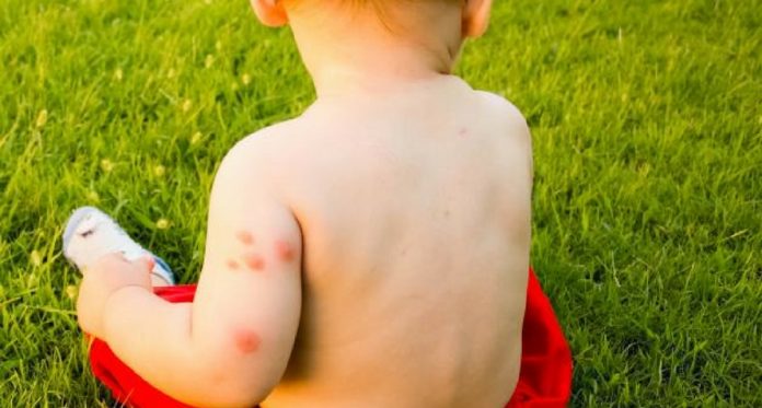 8 cara penyakit yang dibawa nyamuk dapat membahayakan perkembangan keseluruhan anak Anda