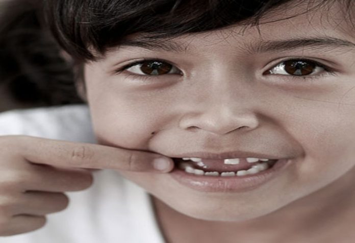 Perkembangan Gigi pada Anak Sekolah