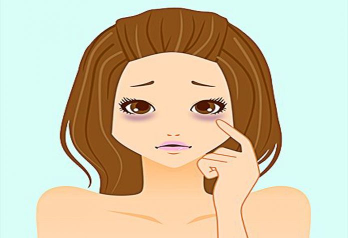 Tips Make-up untuk Menyembunyikan Lingkaran Hitam