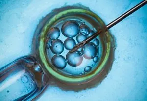 Fertilisasi In Vitro (IVF) untuk Perawatan Infertilitas