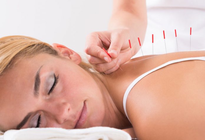 pengobatan akupunktur