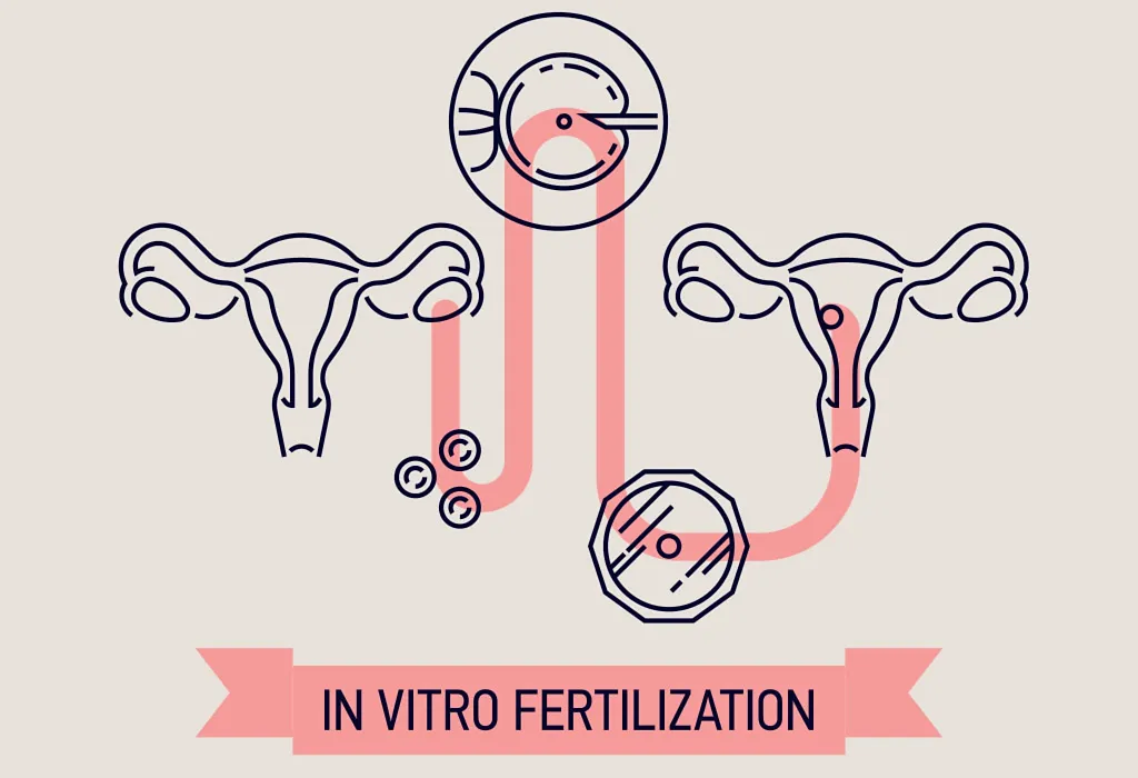 Teknologi Reproduksi Berbantu (ART) – Perawatan Infertilitas