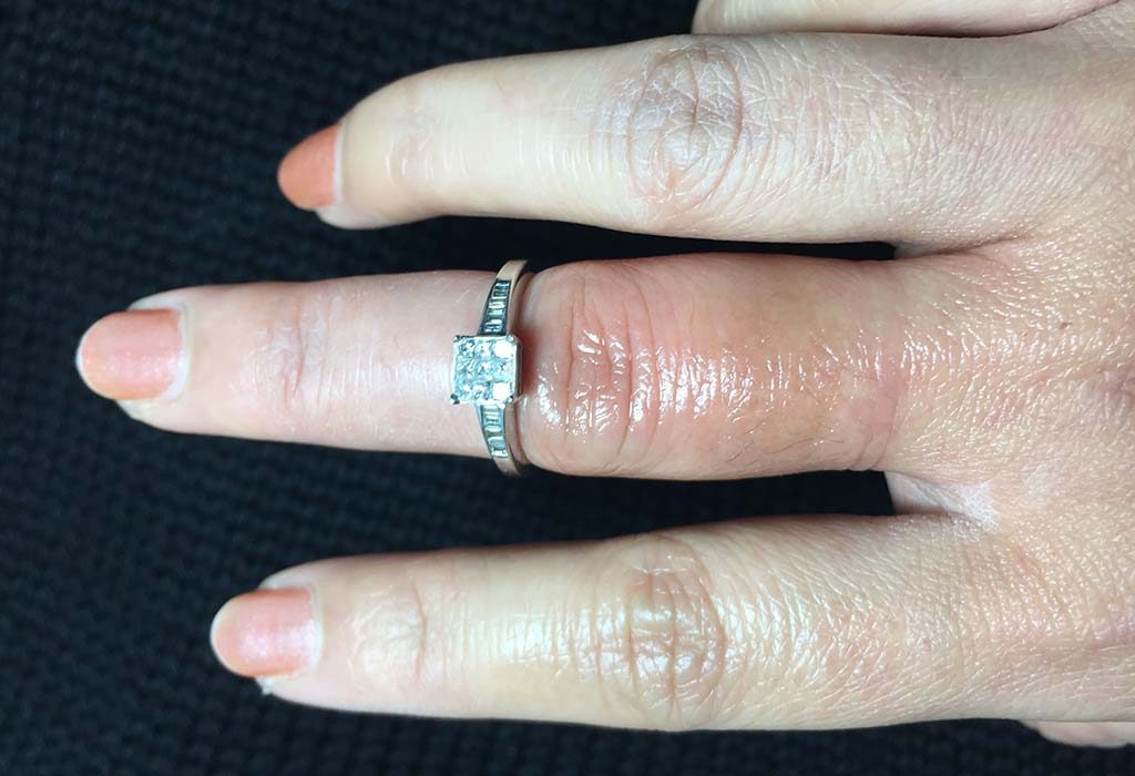 Seorang wanita melepas cincin dari jarinya
