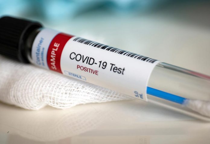 Kita Bisa Melawan Virus Corona COVID-19 Tapi Kita Tidak Bisa Melawan Dengan Mentalitas Orang