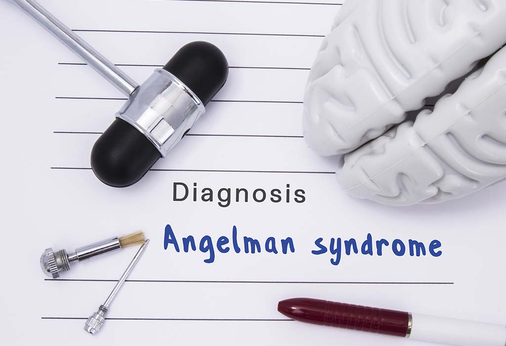 Bagaimana Sindrom Angelman Diobati pada Anak Kecil?