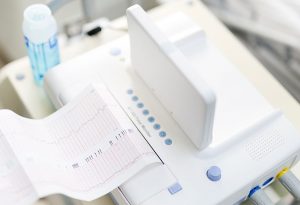 Apa yang Dapat Ditunjukkan Kardiotokografi?