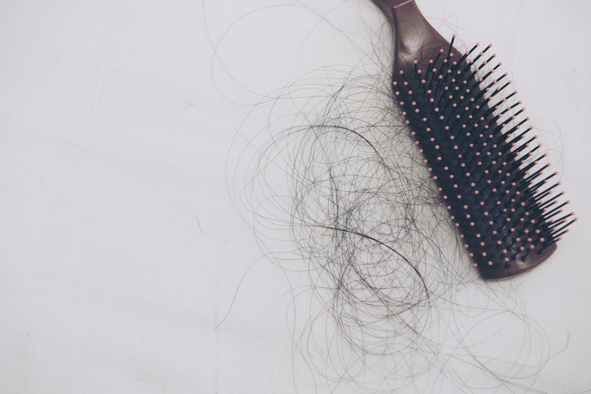 8 penyebab utama rambut rontok (dan apa yang harus dilakukan)_0
