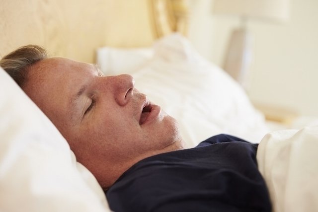 Sleep apnea: apa itu, gejala, penyebab dan pengobatan_0