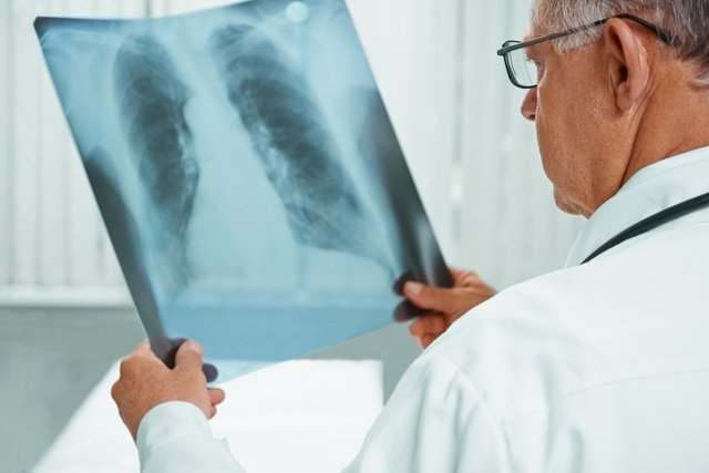 5 penyebab utama air di paru-paru (dan apa yang harus dilakukan)_0