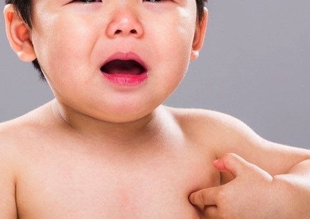 Dengue pada anak-anak: gejala, tanda peringatan dan pengobatan_0