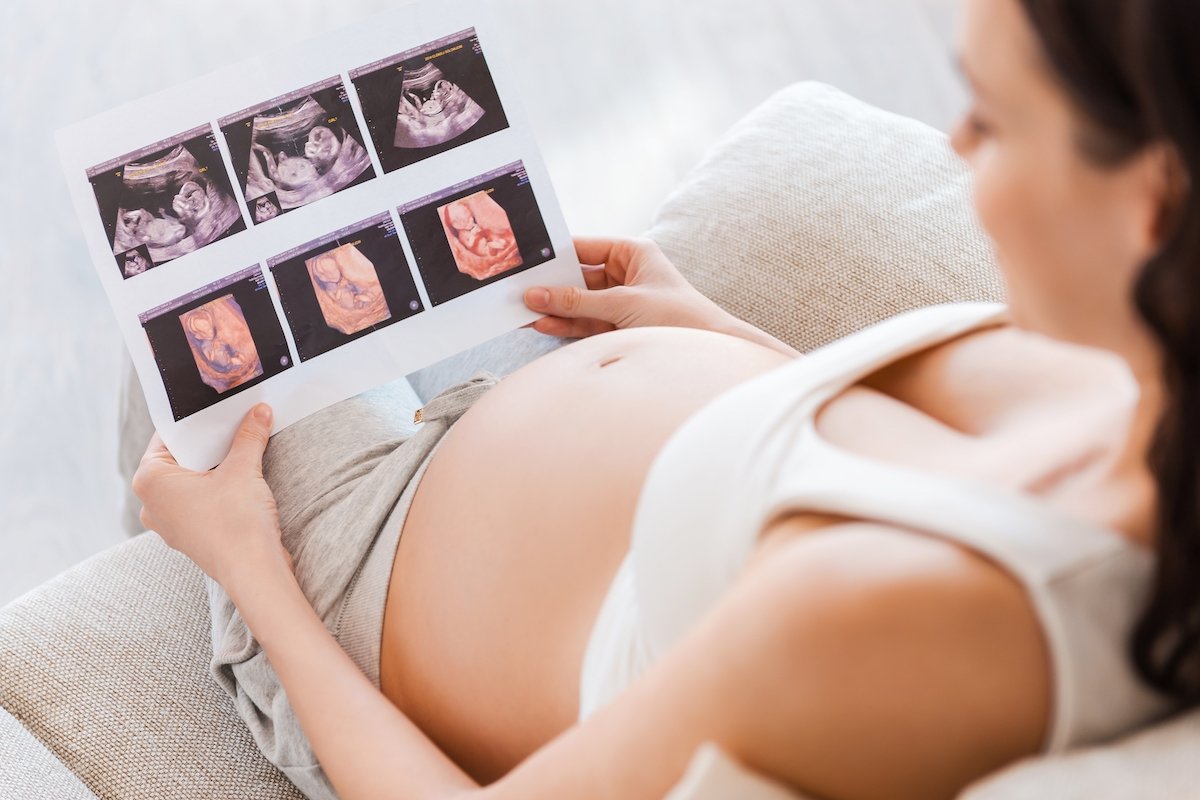 Kehamilan minggu demi minggu: Bagaimana perkembangan bayi_0