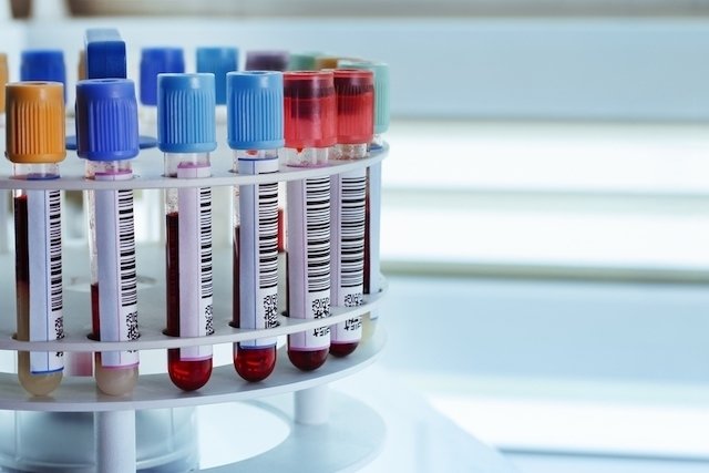Puasa untuk tes darah: tabel dan pertanyaan umum_0